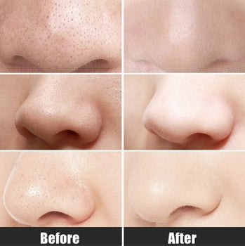 Black-Head Remover ( Free JS cleansing scrub) [NO DELIVERY CHARGES]